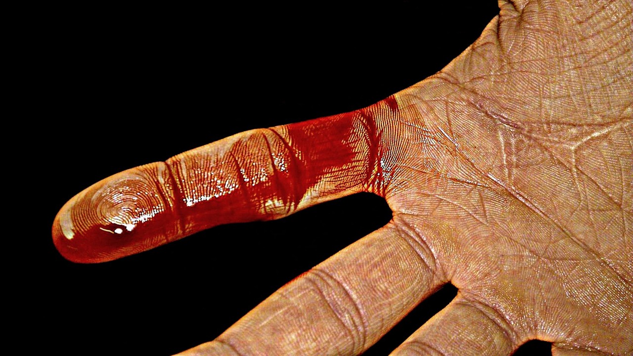 임플란트 잇몸 통증 약